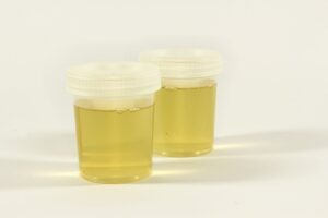 An example of containers for a salt urine pregnancy test