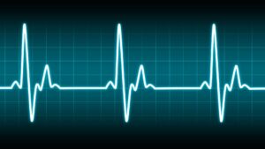 An EKG scan representing a fetal heartbeat